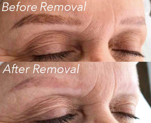 Remove & Perfect Package!