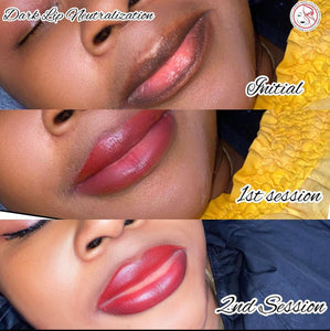 Dark Lip Neutralization