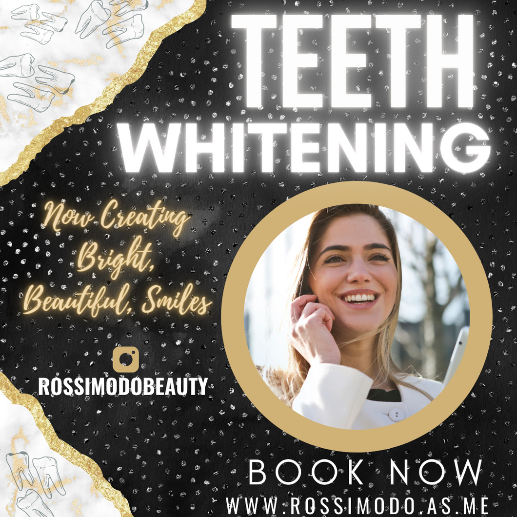 Deluxe Teeth Whitening Service